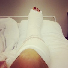 bandaged-leg1.jpg